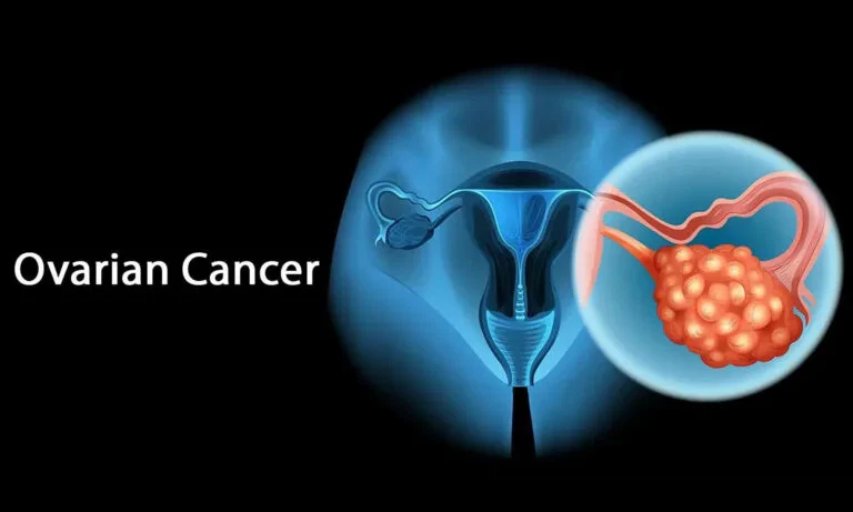 Female DNA Testing - ovarian cancer graphic image